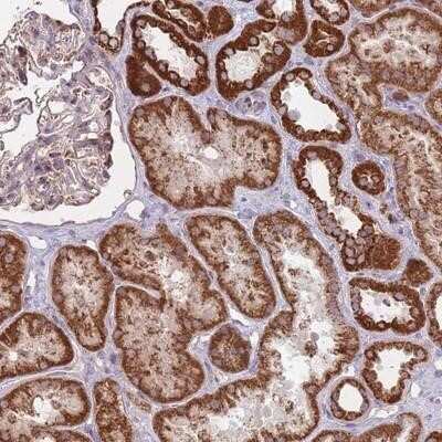 Immunohistochemistry-Paraffin: LIN7C Antibody [NBP2-14193]