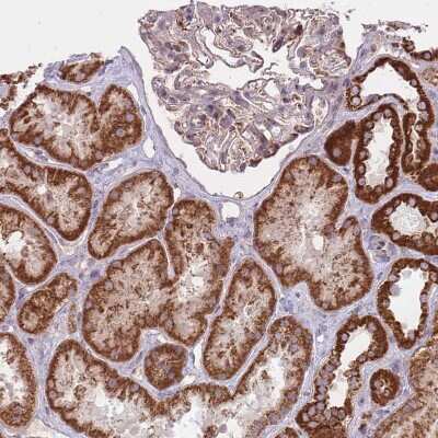 Immunohistochemistry-Paraffin: LIN7C Antibody [NBP2-14193]