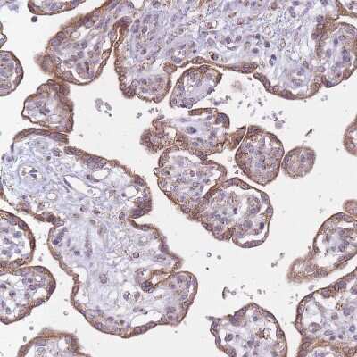 Immunohistochemistry-Paraffin: LIN7C Antibody [NBP2-14193]