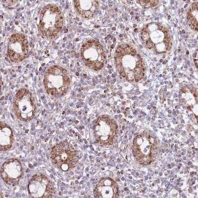 Immunohistochemistry-Paraffin: LIN7C Antibody [NBP2-14193]