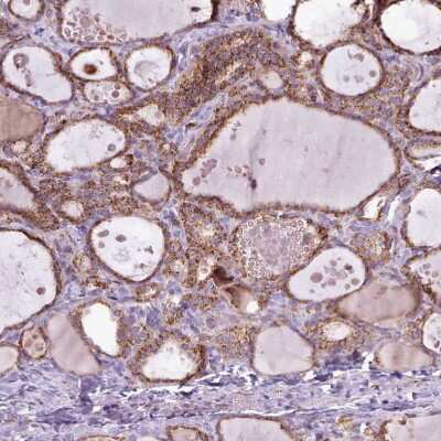 Immunohistochemistry-Paraffin: LIN7C Antibody [NBP2-14193]