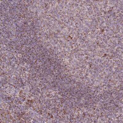 Immunohistochemistry-Paraffin: LIN7C Antibody [NBP2-14193]