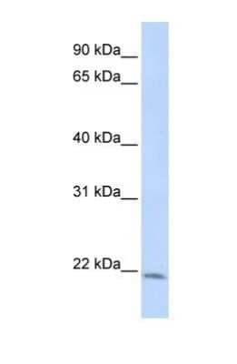 Western Blot: LIN7C Antibody [NBP1-53082]