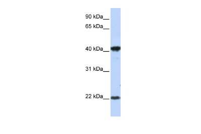 Western Blot: LIN7C Antibody [NBP2-85211]