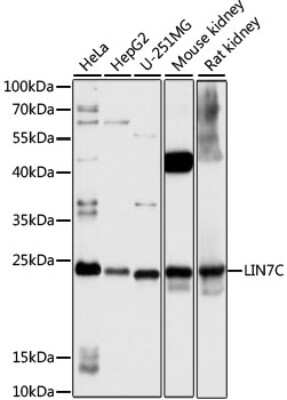 Western Blot: LIN7C AntibodyAzide and BSA Free [NBP3-04771]