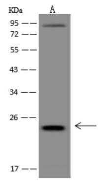 Western Blot: LIN7C Antibody [NBP3-06033]