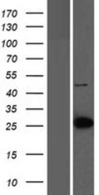 Western Blot: LIN7C Overexpression Lysate [NBP2-06816]