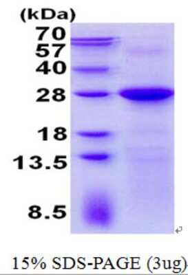 SDS-PAGE: Recombinant Human LIN7C His Protein [NBP2-23199]