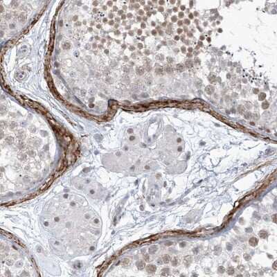 Immunohistochemistry-Paraffin: LIN9 Antibody [NBP1-80690]