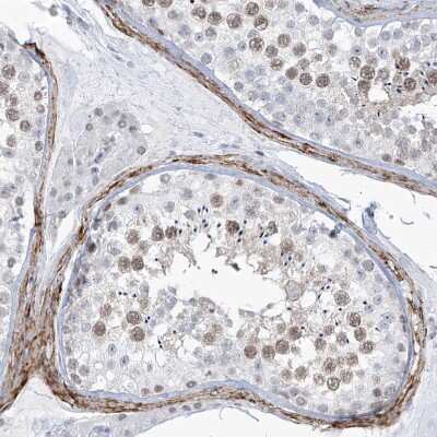 Immunohistochemistry-Paraffin: LIN9 Antibody [NBP1-80690]