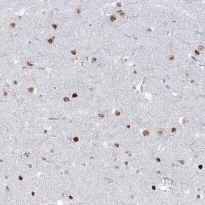 Immunohistochemistry-Paraffin: LIN9 Antibody [NBP1-80690]