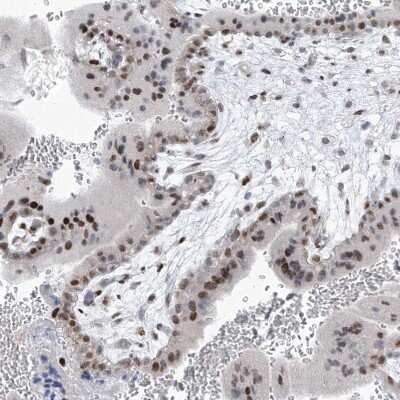 Immunohistochemistry-Paraffin: LIN9 Antibody [NBP1-80690]