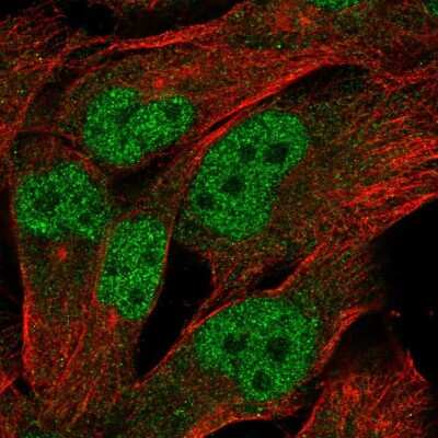 Immunocytochemistry/ Immunofluorescence: LINC00493 Antibody [NBP2-55814]