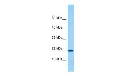 Western Blot: LINC02694 Antibody [NBP2-82850]