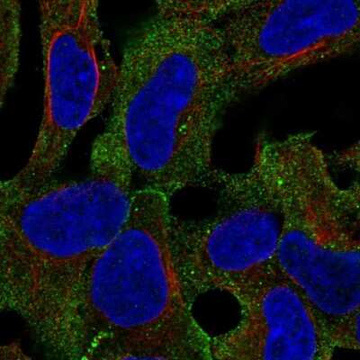 Immunocytochemistry/ Immunofluorescence: LINGO-1 Antibody [NBP2-57689]