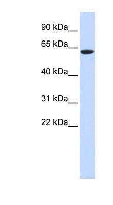 Western Blot: LINGO-4 Antibody [NBP1-70601]