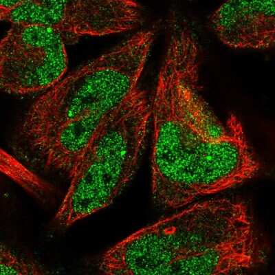 Immunocytochemistry/ Immunofluorescence: LINS1 Antibody [NBP2-58628]