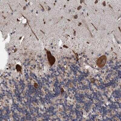 Immunohistochemistry-Paraffin: LINS1 Antibody [NBP1-89584]