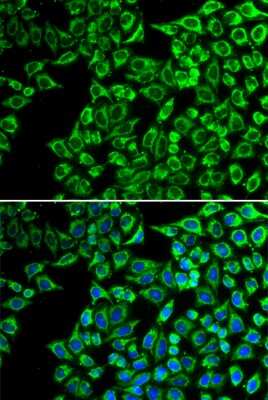 Immunocytochemistry/ Immunofluorescence: LIPC Antibody - BSA Free [NBP3-04922]