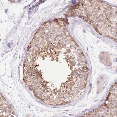 Immunohistochemistry-Paraffin: LIPH Antibody [NBP2-14194]