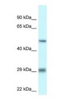 Western Blot: LIPH Antibody [NBP1-79898]