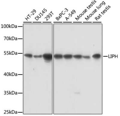 Western Blot: LIPH AntibodyAzide and BSA Free [NBP3-03946]