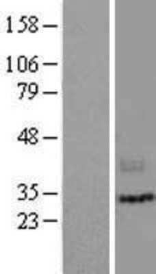 Western Blot: LIPH Overexpression Lysate [NBP2-04421]