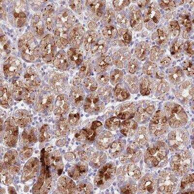 Immunohistochemistry-Paraffin: LIPJ Antibody [NBP2-14195]