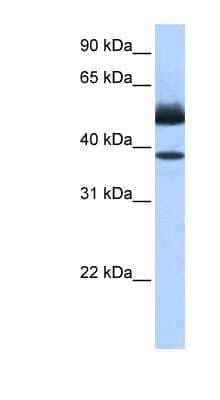 Western Blot: LIPJ Antibody [NBP1-70602]