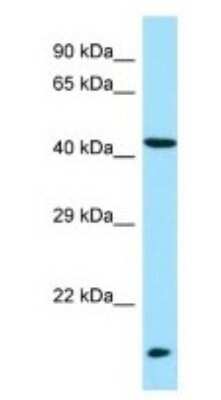 Western Blot: LIPM Antibody [NBP1-98283]