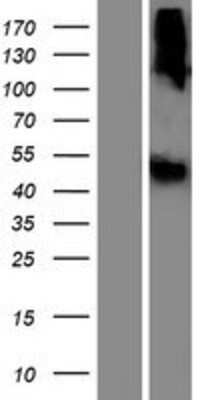 Western Blot: LIPN Overexpression Lysate [NBP2-08240]