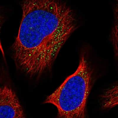 Immunocytochemistry/ Immunofluorescence: LIPT2 Antibody [NBP1-91135]