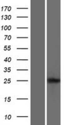 Western Blot: LIPT2 Overexpression Lysate [NBP2-09710]