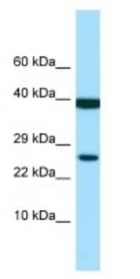 Western Blot: LIR-6/LILRA1 Antibody [NBP3-09438]