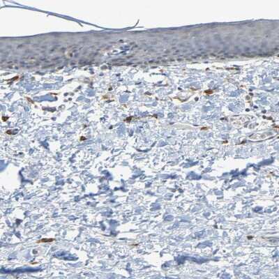 Immunohistochemistry-Paraffin: LIR-8/CD85c/LILRB5 Antibody [NBP1-84575]