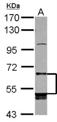 Western Blot: LIR-8/CD85c/LILRB5 Antibody [NBP2-19352]