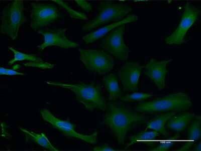 Immunocytochemistry/ Immunofluorescence: LIS1 Antibody (5A5) [H00005048-M03]