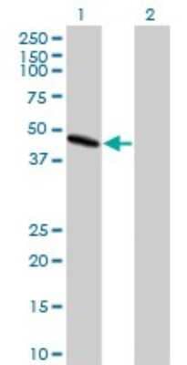 Western Blot: LIS1 Antibody (5A5) [H00005048-M03]