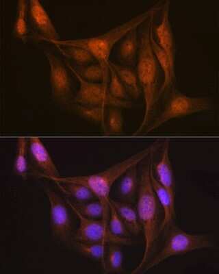Immunocytochemistry/ Immunofluorescence: LIS1 Antibody (9O6X3) [NBP3-16253]