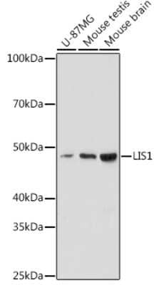 Western Blot: LIS1 Antibody (9O6X3) [NBP3-16253]