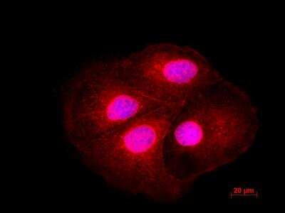 Immunocytochemistry/ Immunofluorescence: LIS1 Antibody [NBP1-87769]
