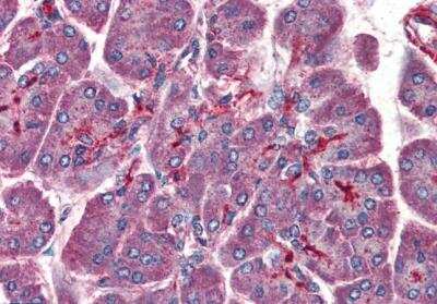 Immunohistochemistry-Paraffin: LIS1 Antibody [NB100-1040]