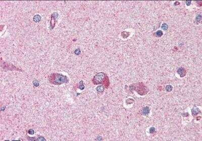 Immunohistochemistry-Paraffin: LIS1 Antibody [NB100-1040]