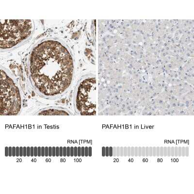 Immunohistochemistry-Paraffin: LIS1 Antibody [NBP1-87769]