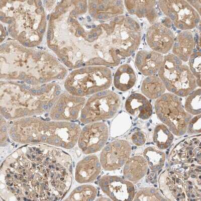 Immunohistochemistry-Paraffin: LIS1 Antibody [NBP1-87769]