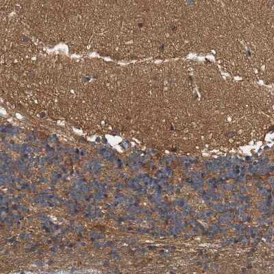 Immunohistochemistry-Paraffin: LIS1 Antibody [NBP1-87769]