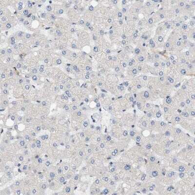 Immunohistochemistry-Paraffin: LIS1 Antibody [NBP1-87769]