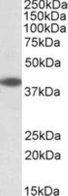 Western Blot: LIS1 Antibody [NB100-1040]