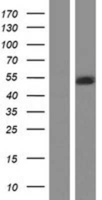 Western Blot: LIS1 Overexpression Lysate [NBP2-10671]