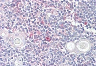 Immunohistochemistry-Paraffin: LITAF Antibody [NBP1-00208]